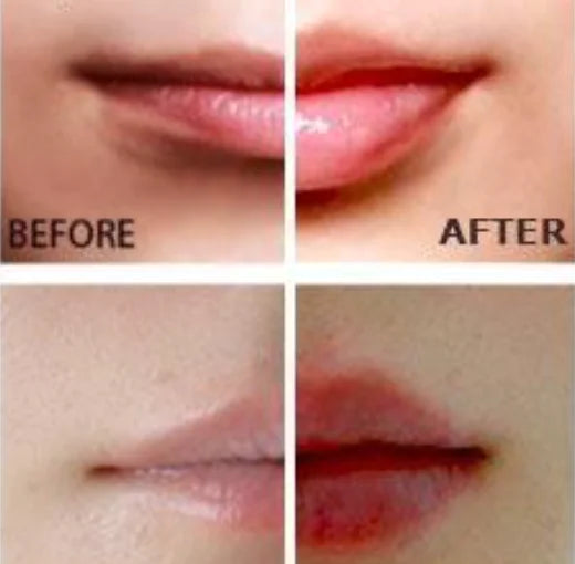 Miracle Lip Plumper - Image 2